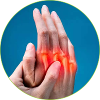 Knee Surgery - Rheumatoid arthritis